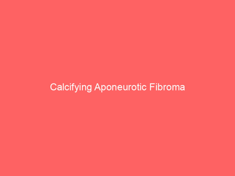 Calcifying Aponeurotic Fibroma