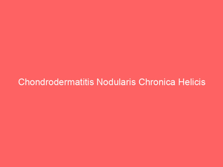 Chondrodermatitis Nodularis Chronica Helicis
