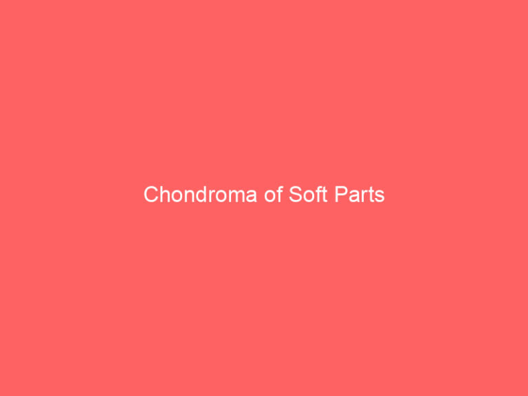 Chondroma of Soft Parts