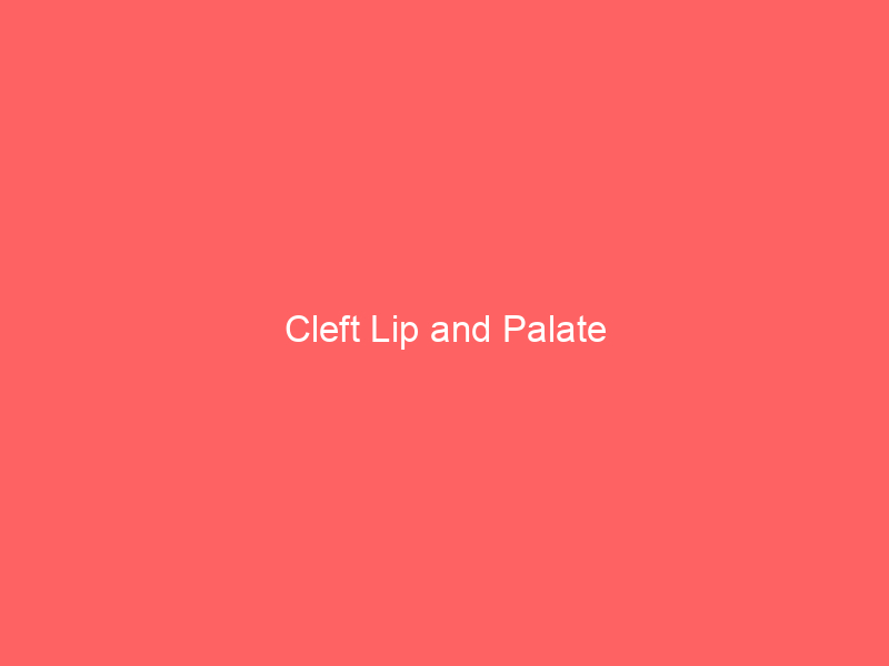 Cleft Lip and Palate