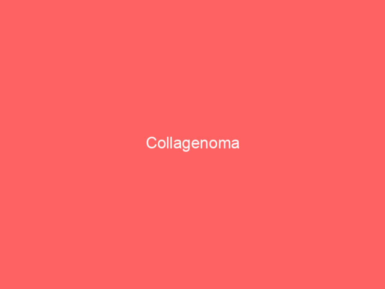 Collagenoma