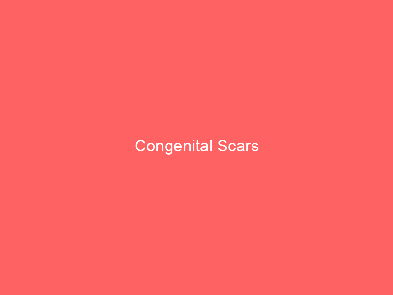 Congenital Scars