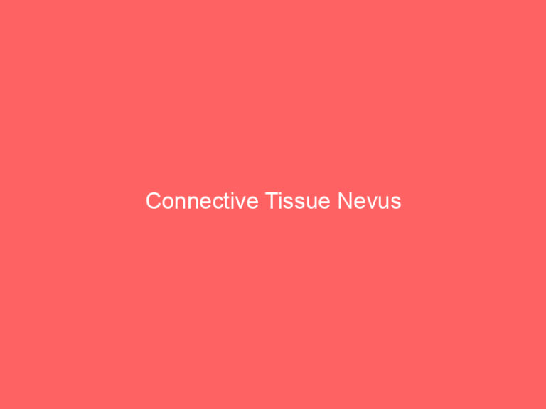 Connective Tissue Nevus