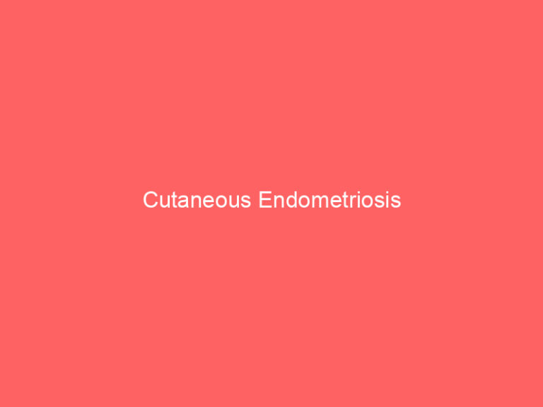 Cutaneous Endometriosis