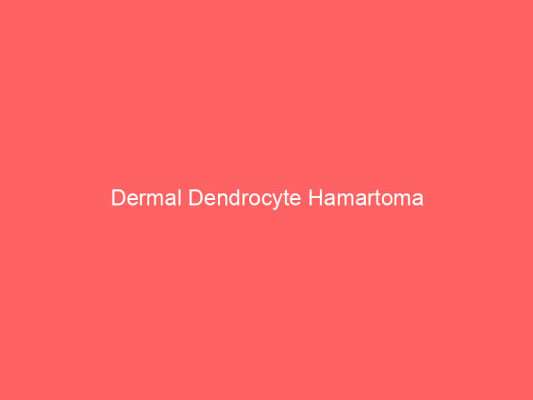 Dermal Dendrocyte Hamartoma
