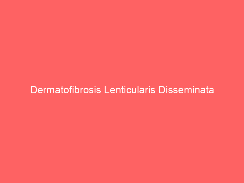 Dermatofibrosis Lenticularis Disseminata