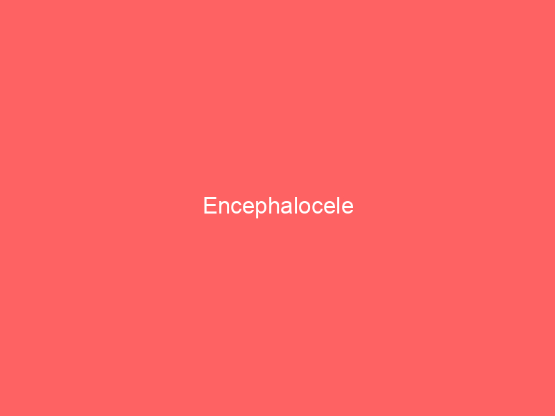 Encephalocele