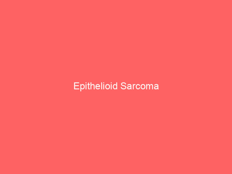 Epithelioid Sarcoma
