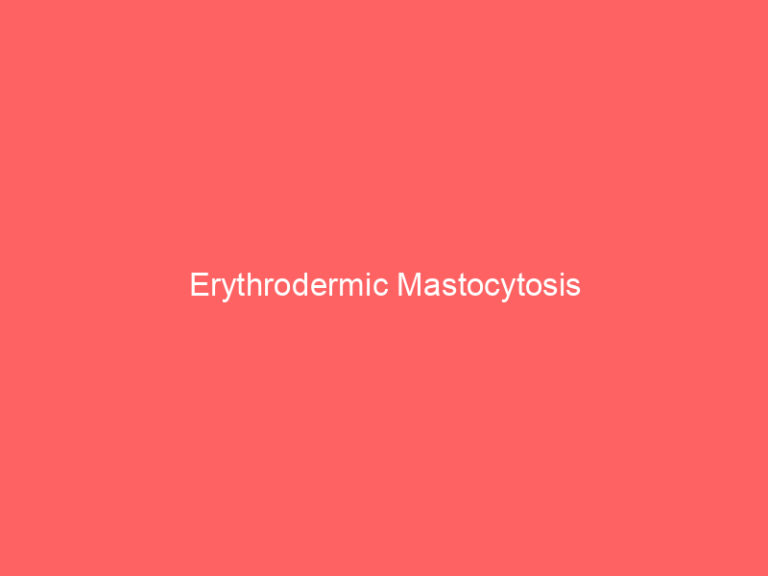 Erythrodermic Mastocytosis