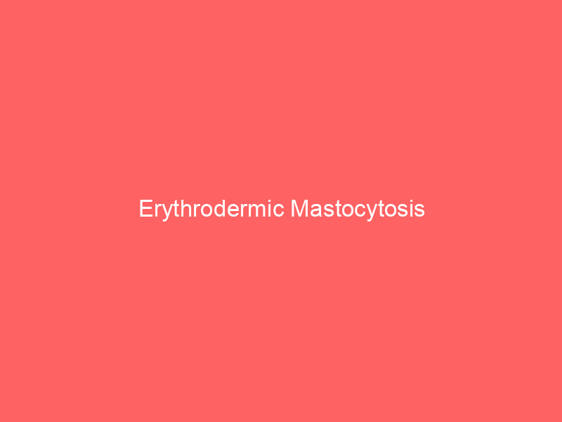 Erythrodermic Mastocytosis