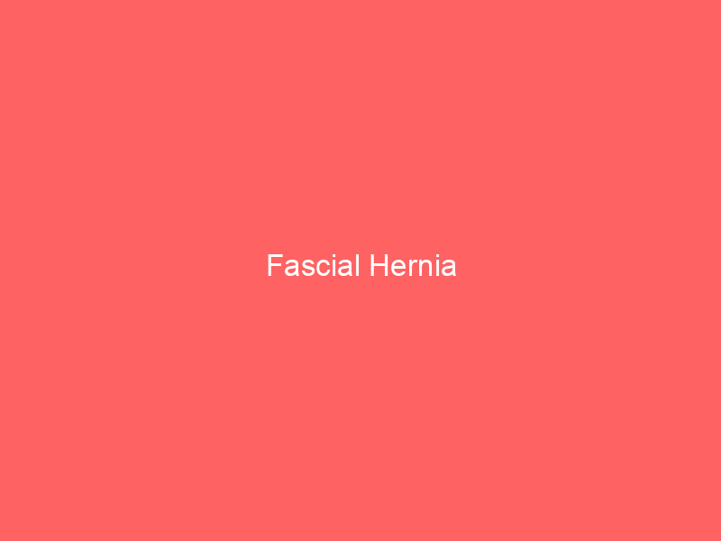Fascial Hernia