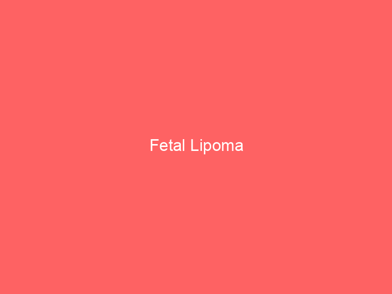 Fetal Lipoma
