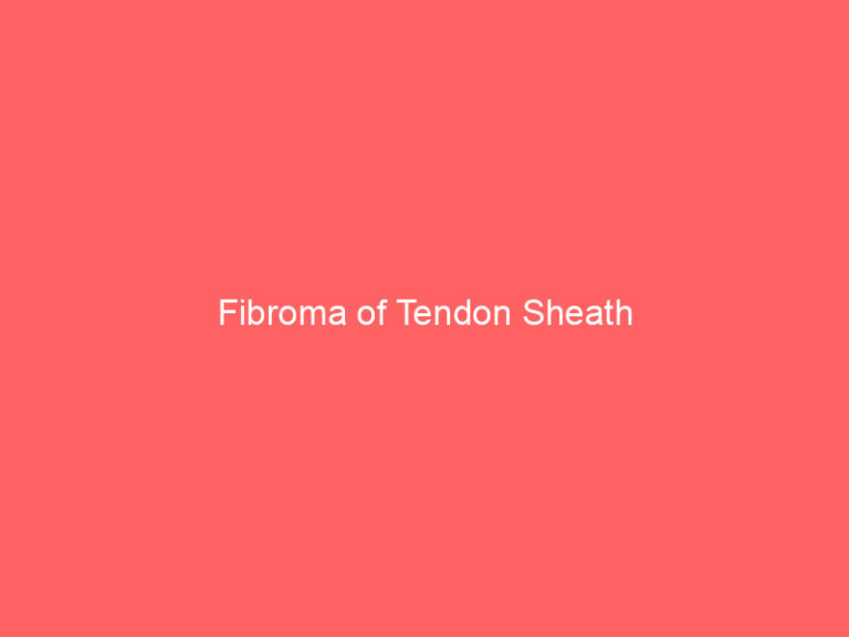 Fibroma of Tendon Sheath
