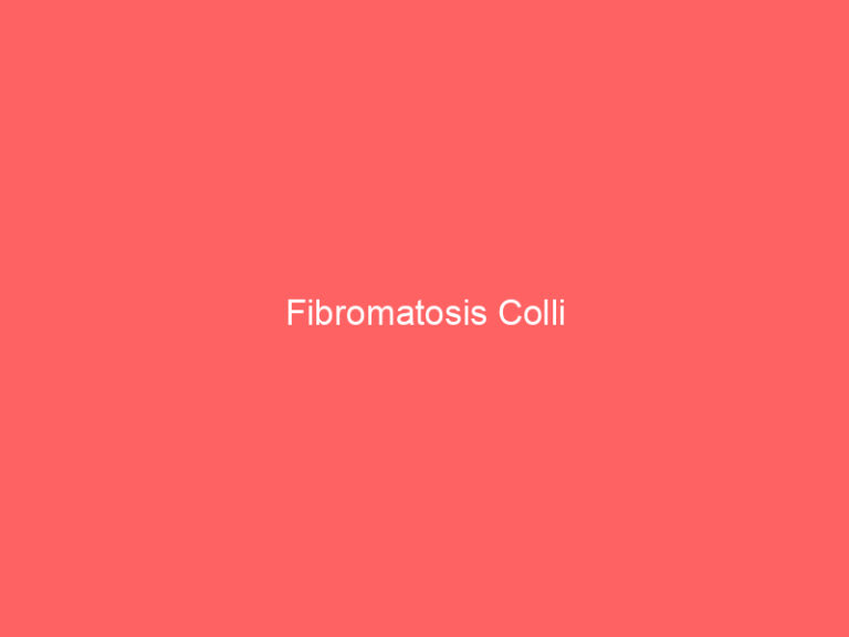 Fibromatosis Colli