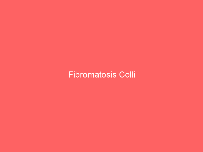 Fibromatosis Colli