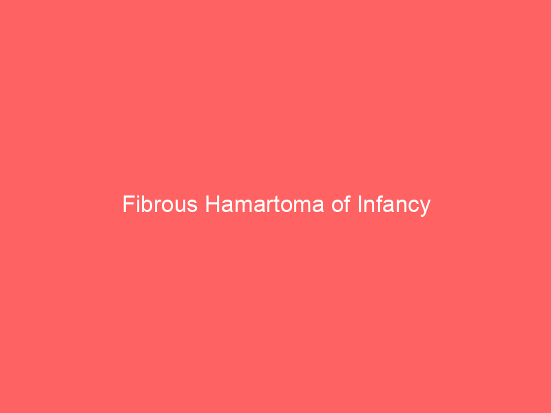 Fibrous Hamartoma of Infancy
