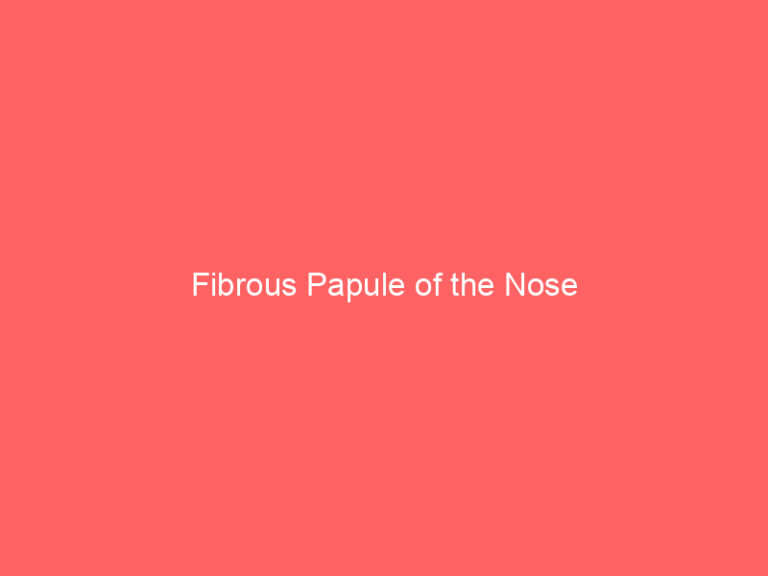 Fibrous Papule of the Nose