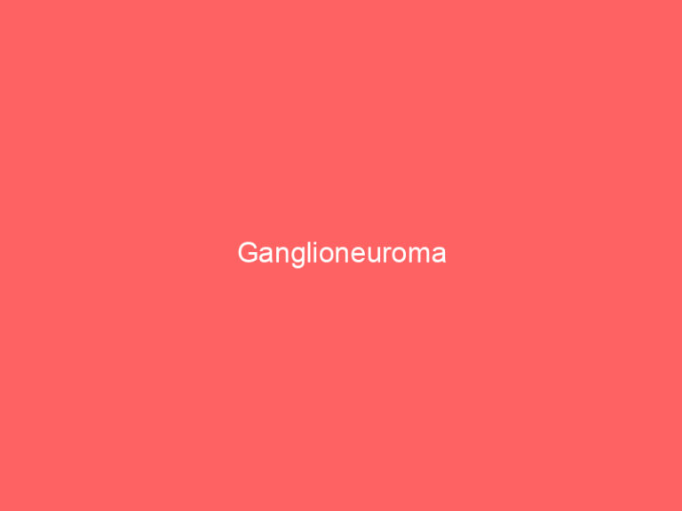 Ganglioneuroma