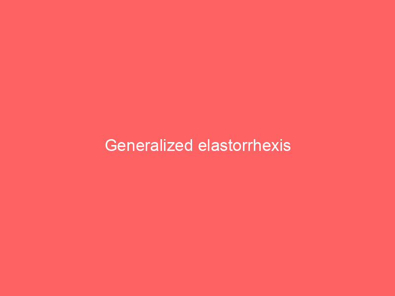 Generalized elastorrhexis