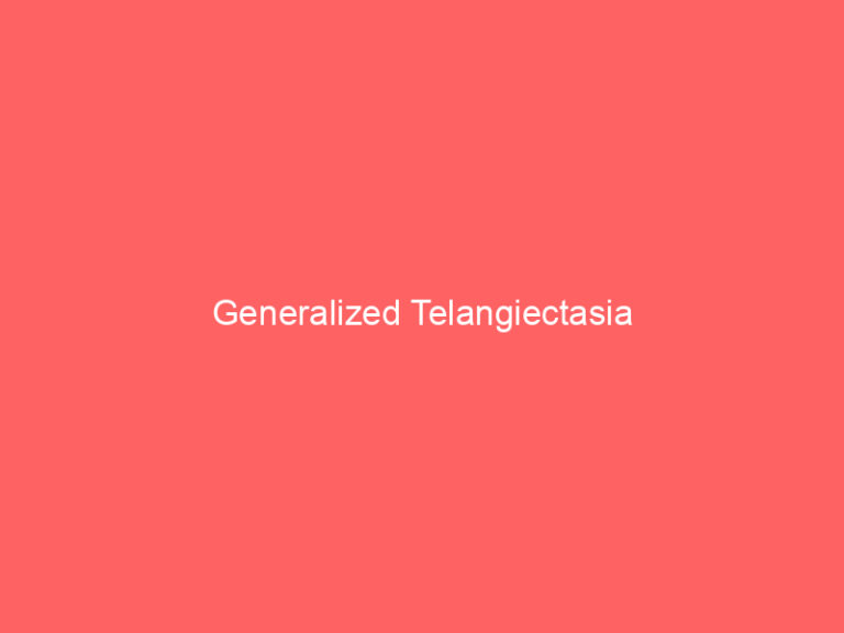 Generalized Telangiectasia