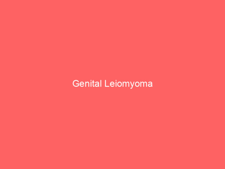 Genital Leiomyoma
