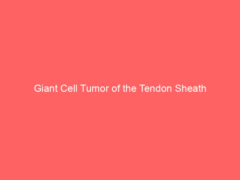Giant Cell Tumor of the Tendon Sheath