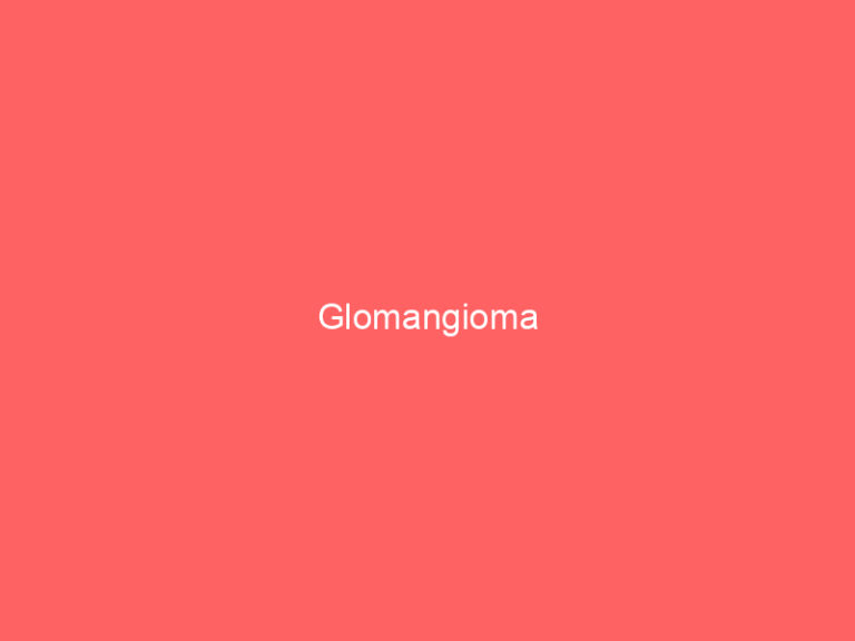 Glomangioma