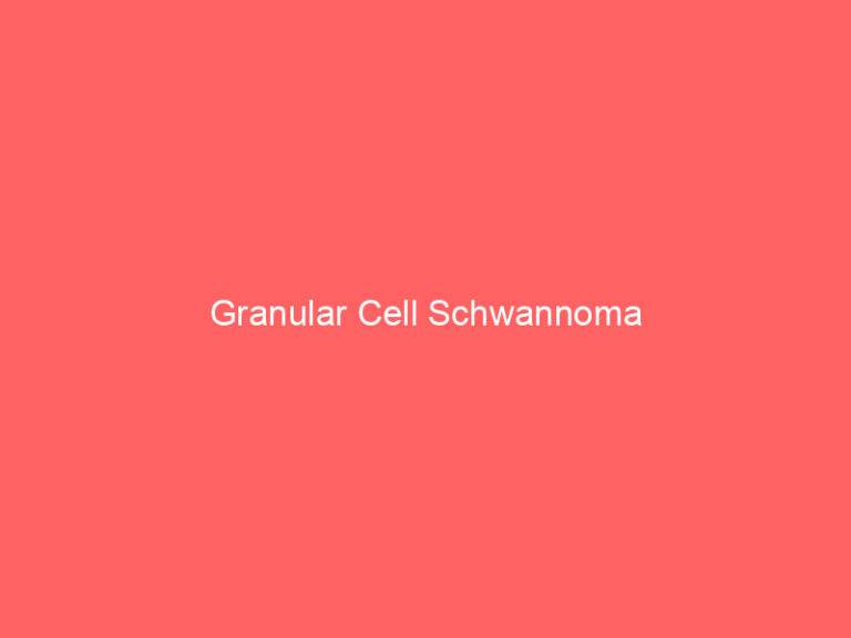 Granular Cell Schwannoma