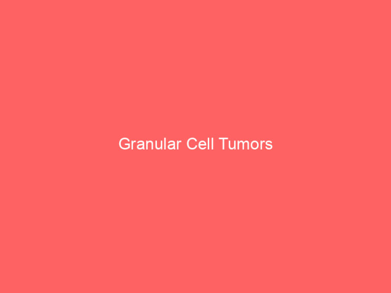 Granular Cell Tumors