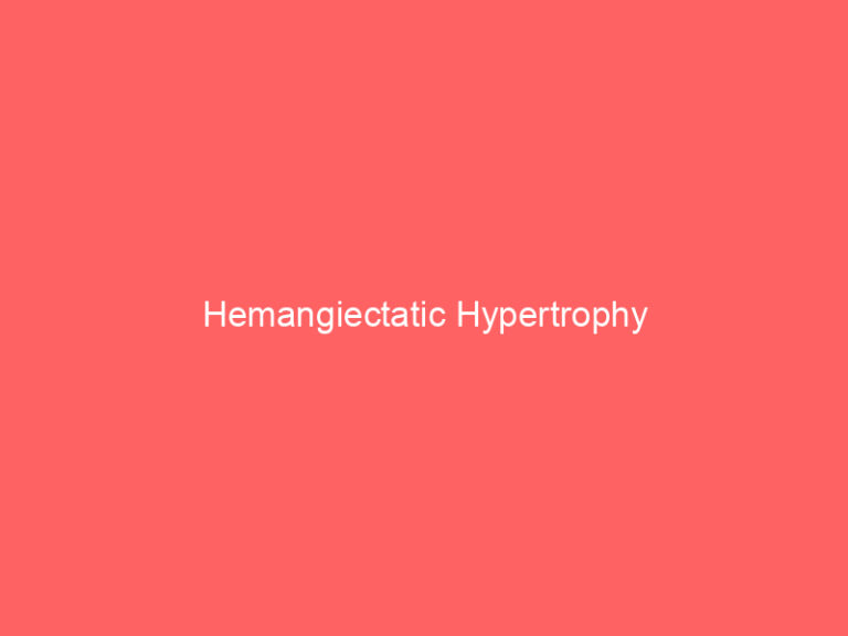 Hemangiectatic Hypertrophy