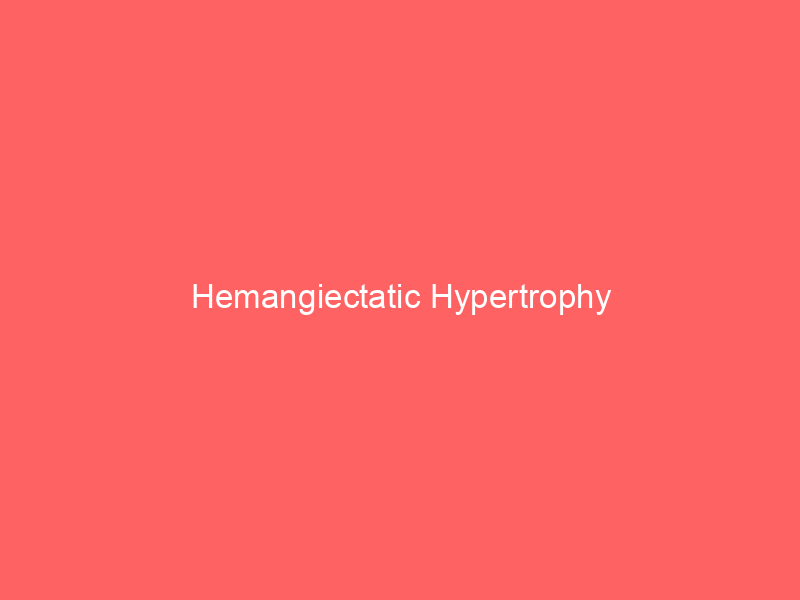 Hemangiectatic Hypertrophy