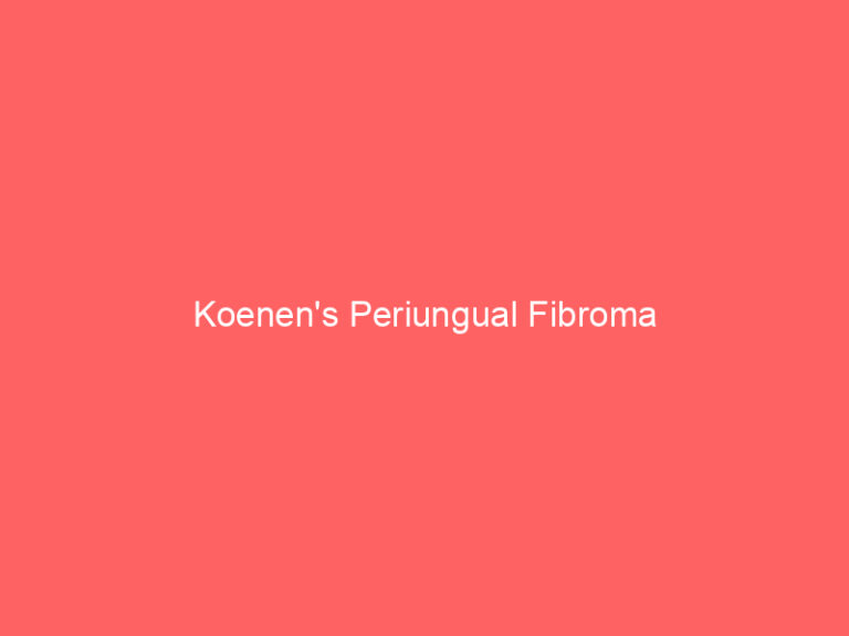 Koenen's Periungual Fibroma