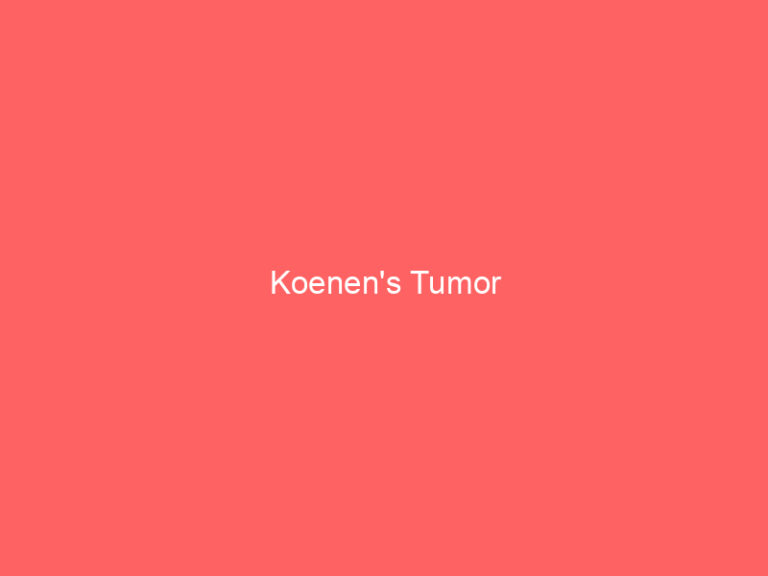 Koenen's Tumor
