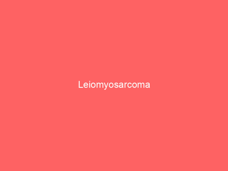 Leiomyosarcoma
