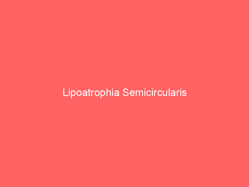 Lipoatrophia Semicircularis