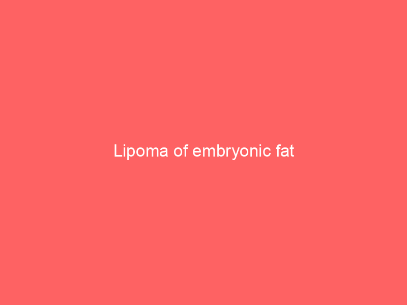 Lipoma of embryonic fat