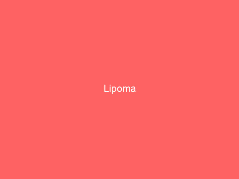 Lipoma