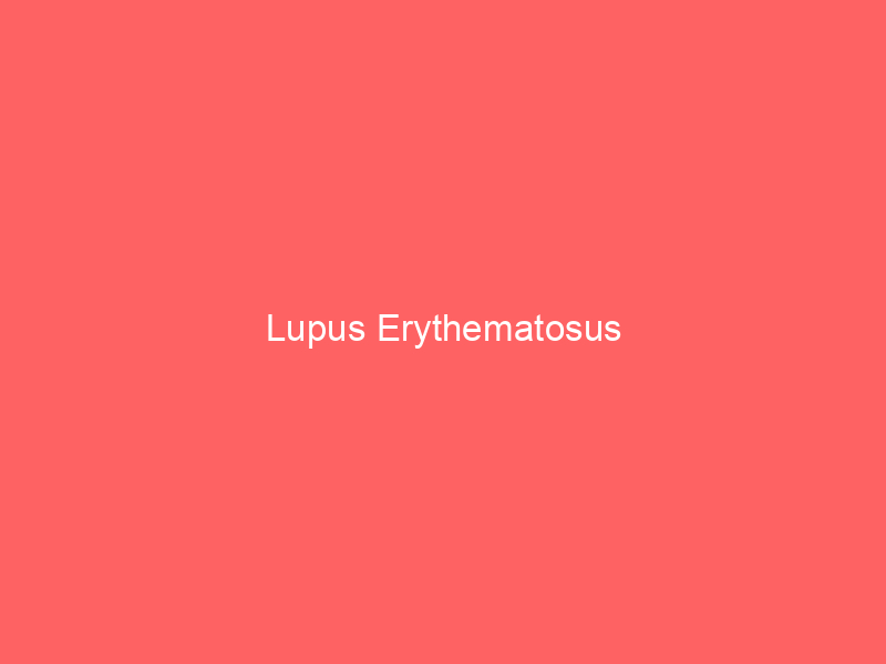 Lupus Erythematosus