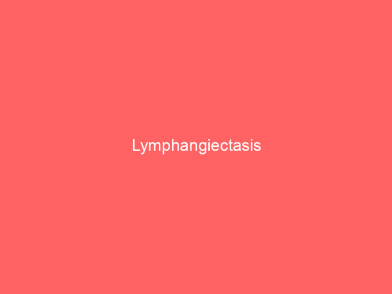 Lymphangiectasis