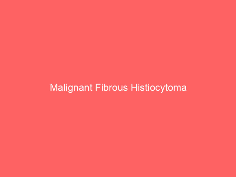 Malignant Fibrous Histiocytoma