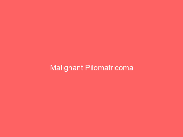 Malignant Pilomatricoma