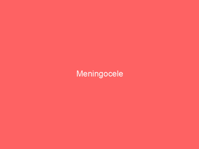 Meningocele