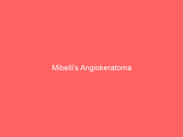 Mibelli's Angiokeratoma