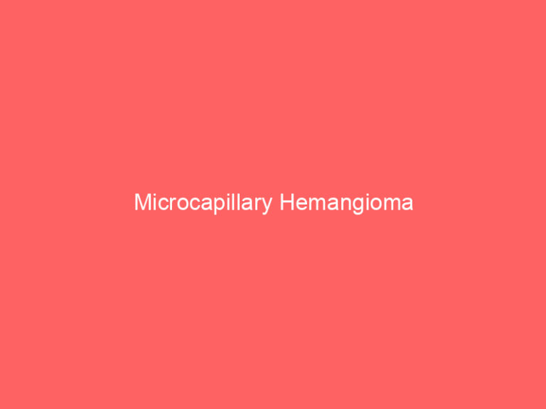 Microcapillary Hemangioma
