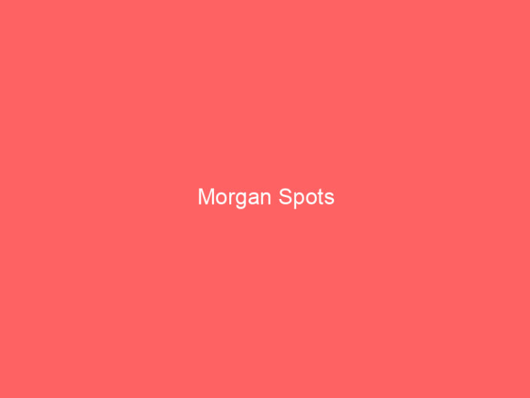 Morgan Spots