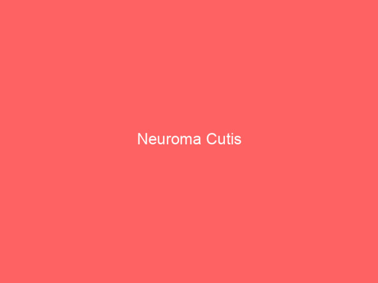 Neuroma Cutis
