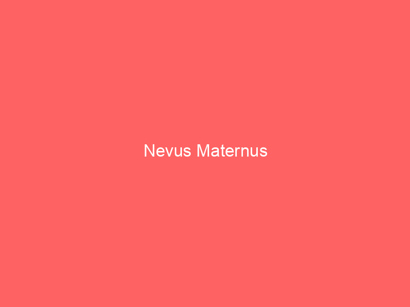Nevus Maternus