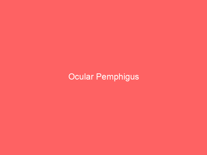 Ocular Pemphigus