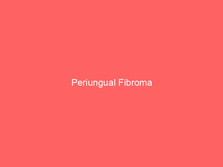 Periungual Fibroma
