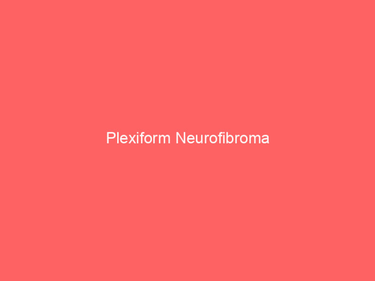 Plexiform Neurofibroma